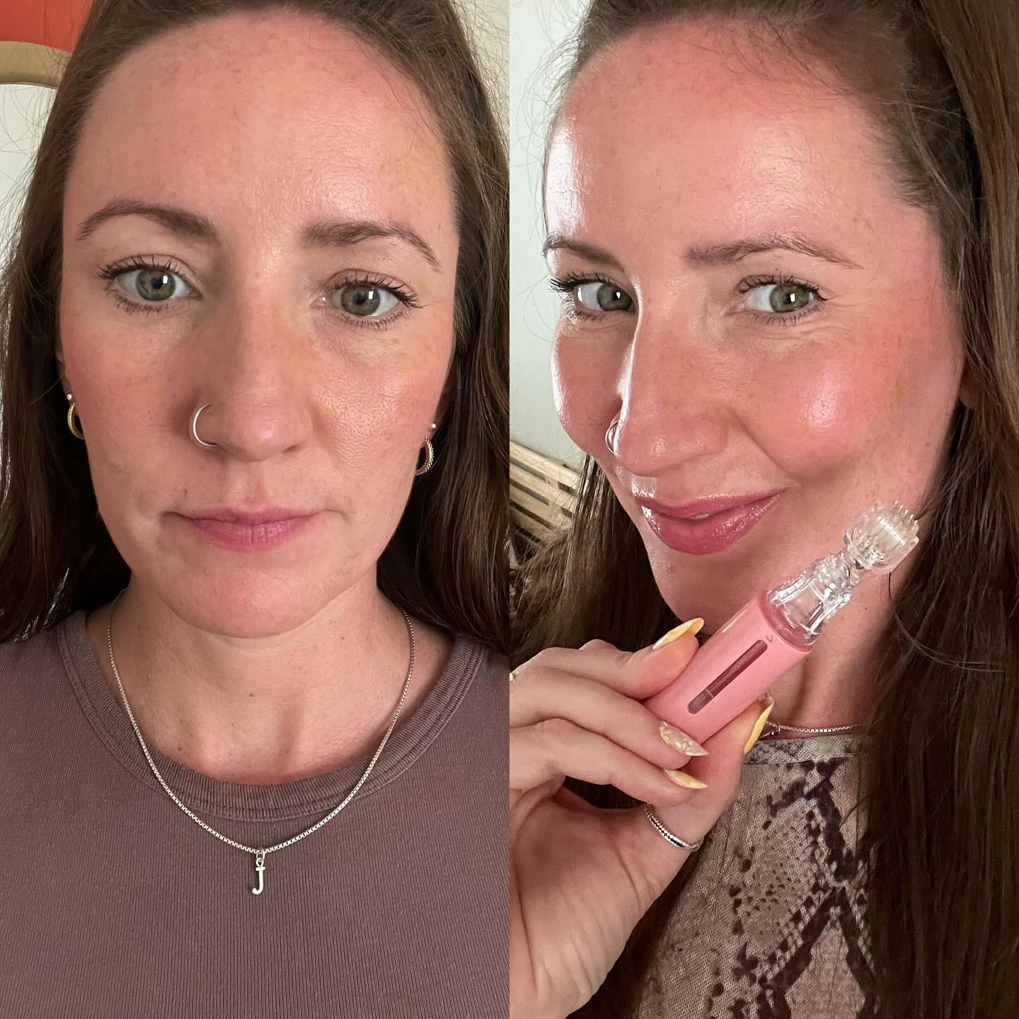 KissBliss™ Lip Booster - GloWaves
