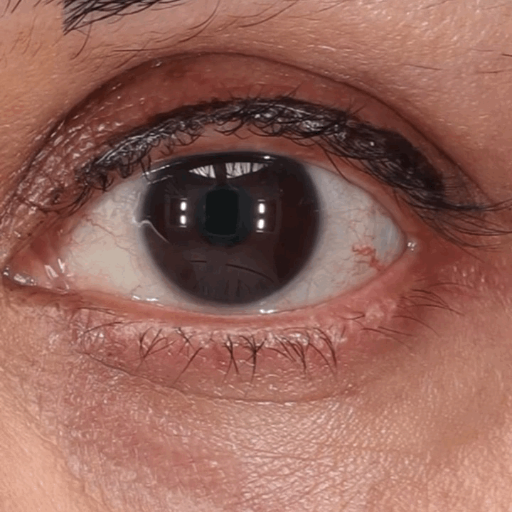 LumiEyes™ Under-Eye Red Light Therapy Goggles