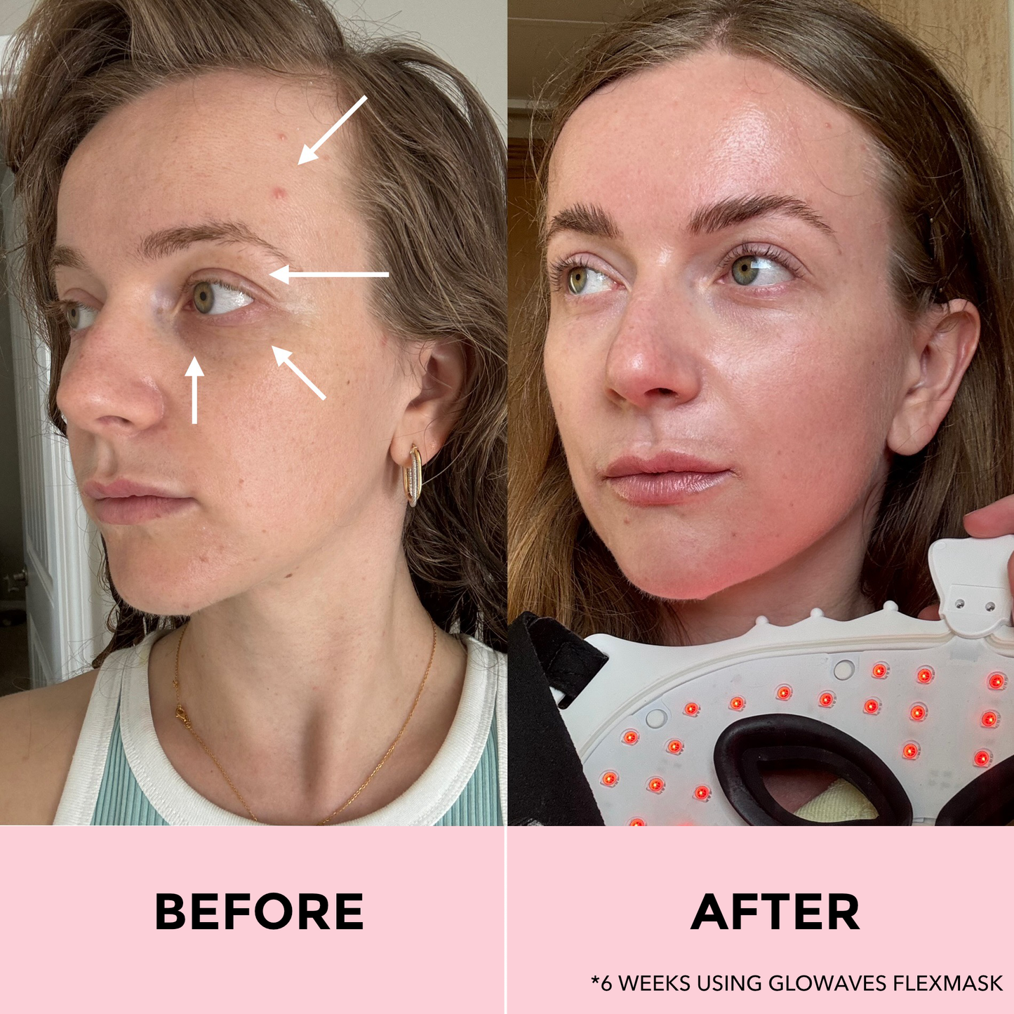 GLOWAVES™ 7-LED THERAPY FLEXMASK - Glowaves