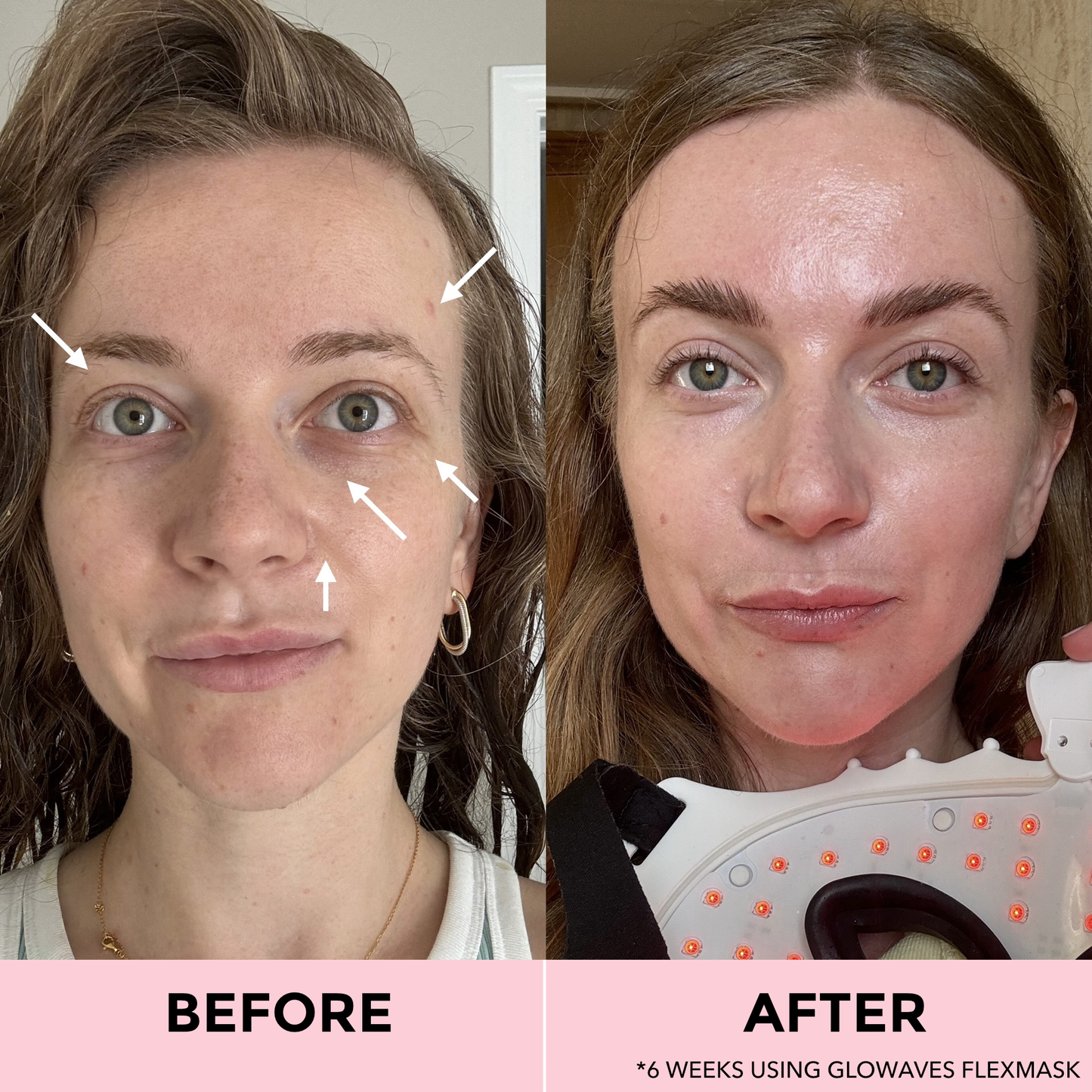 GLOWAVES™ 7-LED THERAPY FLEXMASK - Glowaves